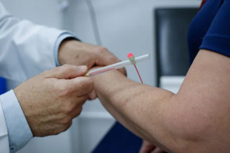 mutirao-de-dermatologia-em-belem-foca-em-diagnostico-de-hanseniase