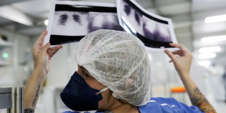 cancer-de-pulmao:-15%-dos-casos-acontecem-em-nao-fumantes
