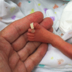 novembro-roxo:-a-luta-e-o-amor-pelos-bebes-prematuros